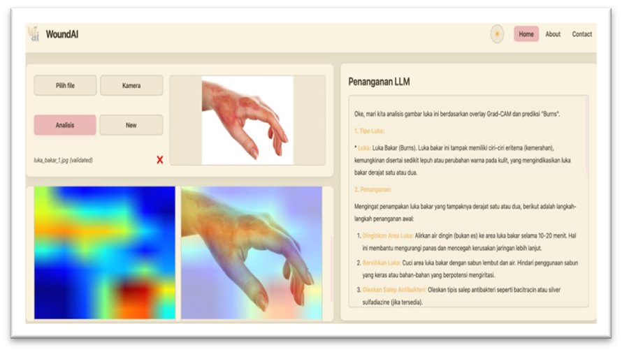 Mahasiswi FILKOM UNKLAB mempresentasikan inovasi digital berbasis AI untuk klasifikasi luka dan edukasi pertolongan pertama.
